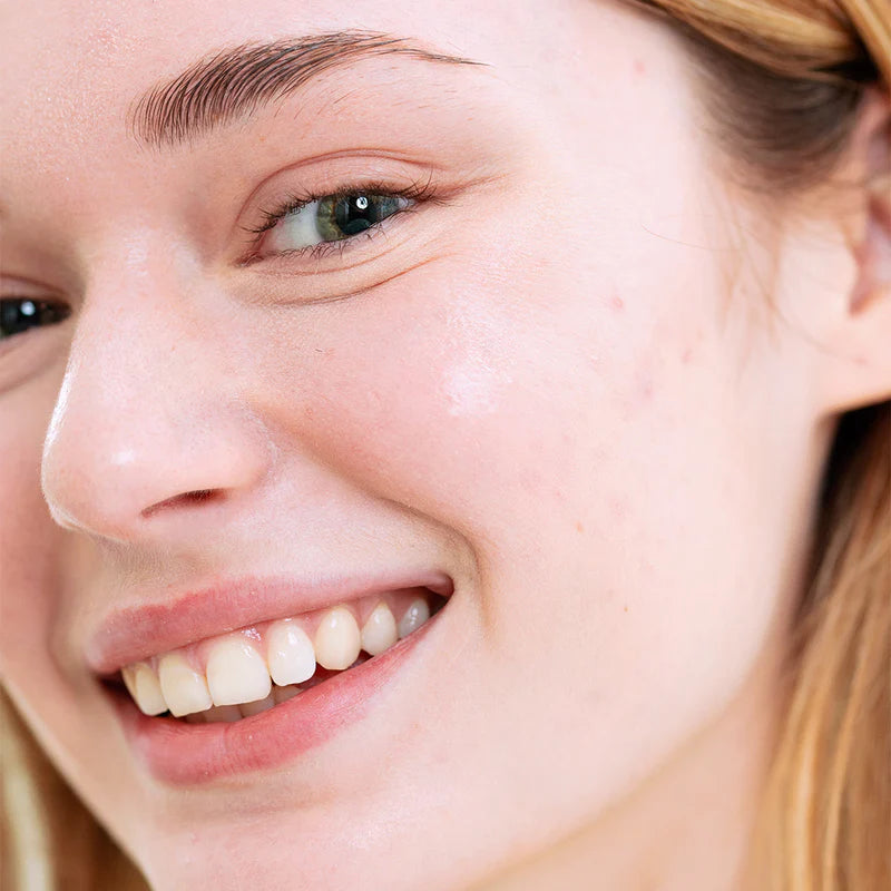 SEBIACLEAR | Peaux à tendance acnéique Crème SPF50+